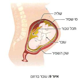 (בספר איור)